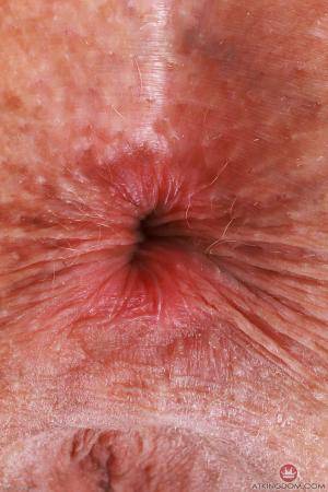 Original 2000 px/ 3000 px