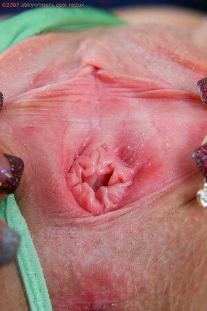 Original 981 px/ 1472 px