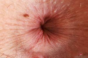 Original 3000 px/ 2000 px