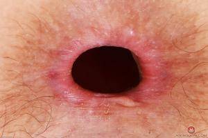 Original 3000 px/ 2000 px