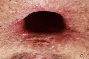 Original 3000 px/ 2000 px