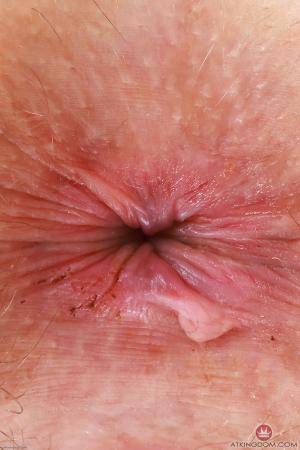 Original 2000 px/ 3000 px