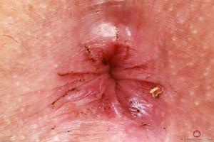 Original 3000 px/ 2000 px