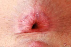 Original 3000 px/ 2000 px