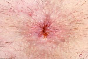 Original 3000 px/ 2000 px