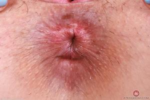 Original 5000 px/ 3332 px