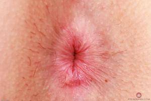 Original 3000 px/ 2000 px