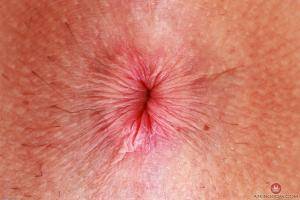 Original 3000 px/ 2000 px