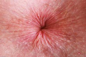 Original 3000 px/ 2000 px