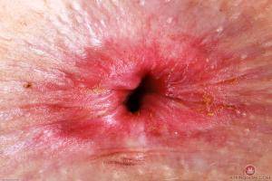 Original 3000 px/ 2000 px