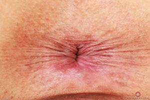 Original 3000 px/ 2000 px