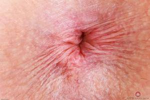 Original 3000 px/ 2000 px