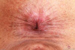 Original 3000 px/ 2000 px