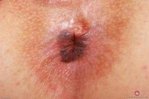 Original 3000 px/ 2000 px