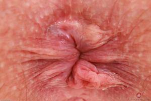 Original 3000 px/ 2000 px