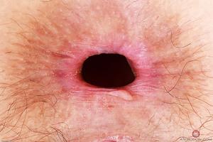 Original 3000 px/ 2000 px