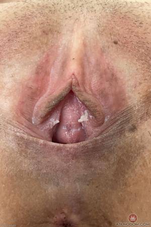 Original 2000 px/ 3000 px