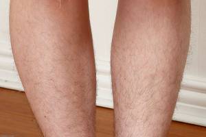 Original 3000 px/ 2001 px