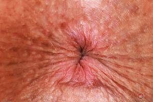 Original 3000 px/ 2000 px