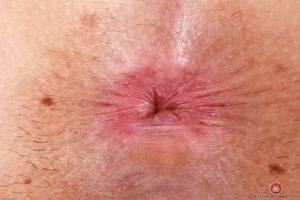 Original 3000 px/ 2000 px