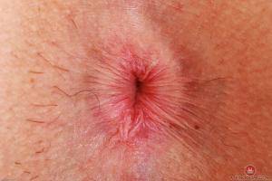 Original 3000 px/ 2000 px