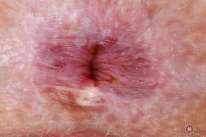 Original 3000 px/ 2000 px