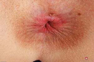 Original 3000 px/ 2000 px