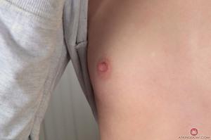 Original 3000 px/ 1992 px