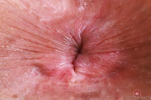 Original 5000 px/ 3333 px