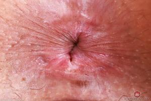 Original 5000 px/ 3333 px