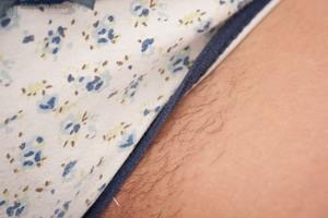 Original 3888 px/ 2592 px