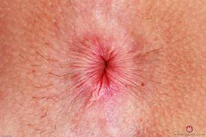 Original 3000 px/ 2000 px