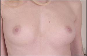 Original 1616 px/ 1050 px