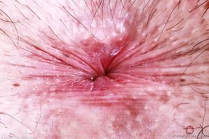 Original 5000 px/ 3333 px