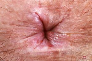 Original 3000 px/ 2000 px