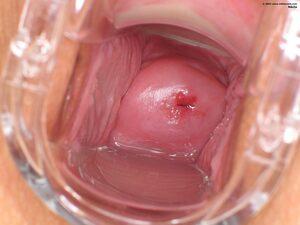 Original 2000 px/ 1500 px