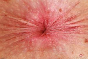 Original 3000 px/ 2000 px