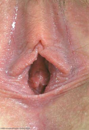 Original 683 px/ 996 px