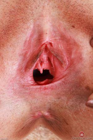 Original 2000 px/ 3000 px