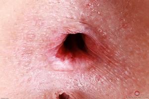 Original 3000 px/ 2000 px