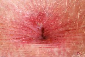 Original 3000 px/ 2000 px