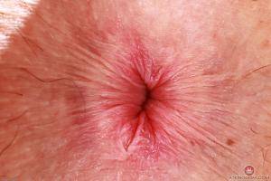 Original 3000 px/ 2000 px