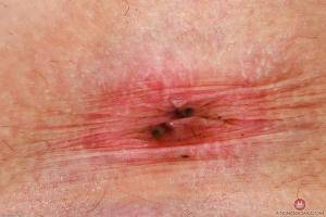 Original 3000 px/ 2000 px