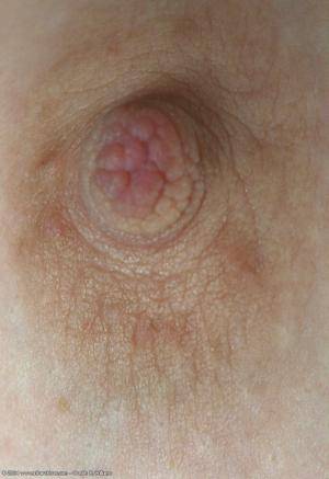 Original 683 px/ 996 px