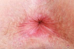 Original 3000 px/ 2000 px