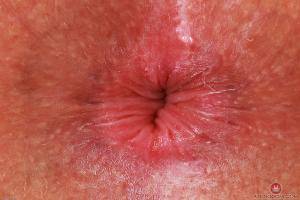 Original 3000 px/ 2000 px