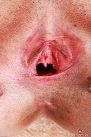 Original 2000 px/ 3000 px