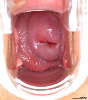 Original 1400 px/ 1600 px