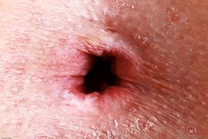 Original 3000 px/ 2000 px