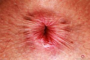 Original 3000 px/ 2000 px